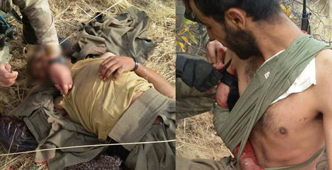 Yaralı PKK'lı teröristi Mehmetçik tedavi etti