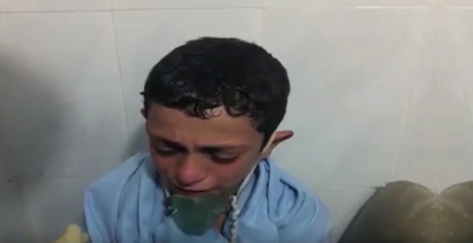 Halep'te bombardımanda yaralanan çocuğun gözyaşları
