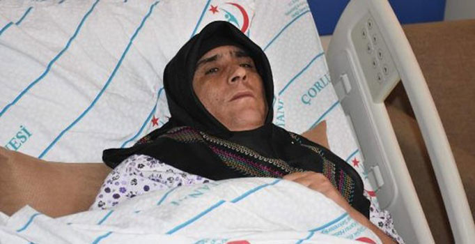 Beyin baloncuklarına ameliyatsız müdahale