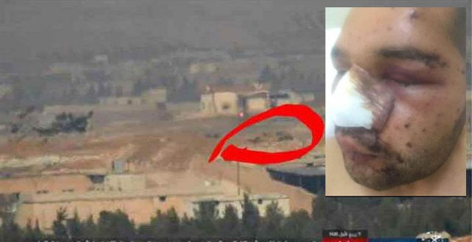 El Bab'da yaralanan Uzman Onbaşı bu fotoğrafı paylaştı!