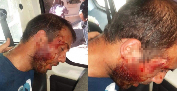 DHA şehit fotoğrafını 
yayınladı teröristi buzladı