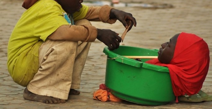 19 yıldır leğende yaşayan Nijeryalı kız hayatını kaybetti