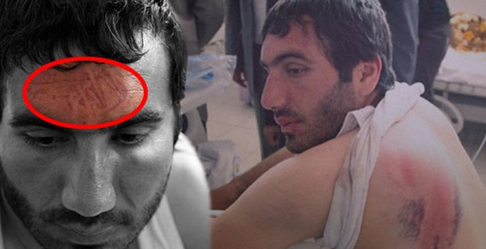 Alında bot izi çıkartan polis şiddeti için Yargıtay'dan emsal karar | Diyarbakır haberleri