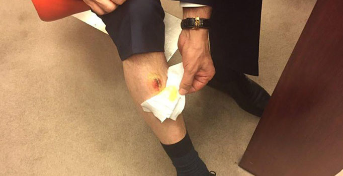 Meclisteki ısırılma olayıyla ilgili soruşturma başlatıldı