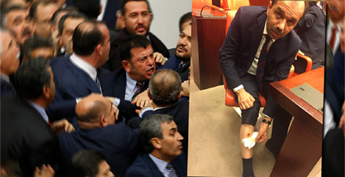 Adli Tıp ’AK Parti Trabzon Milletvekili ısırıldı’ dedi