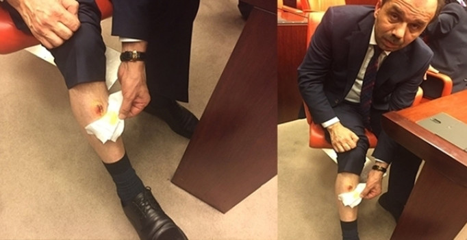 Isırılan milletvekilinin pantolonu adli emanette