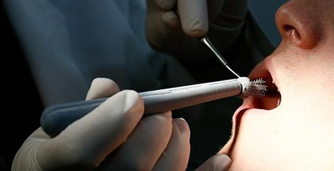 Ağız kanserine karşı "Türk fırçası"nı geliştirdiler