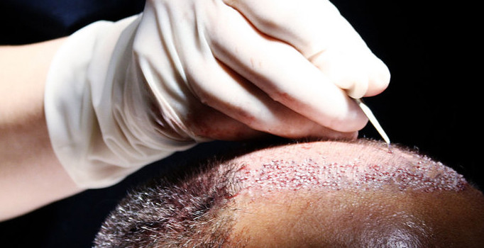 Ankara'da yakalanan DEAŞ'lı teröristin 'saç ektirme' yalanı