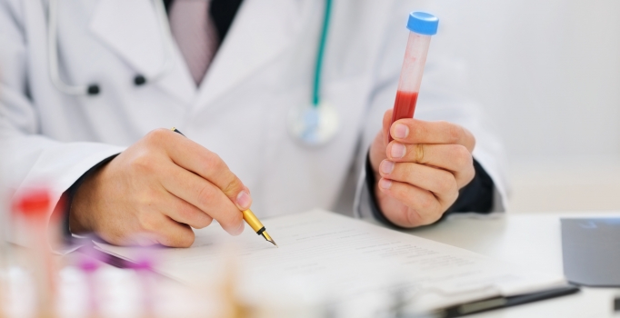 'Nadir testler' için vatandaşlar artık para ödemeyecek