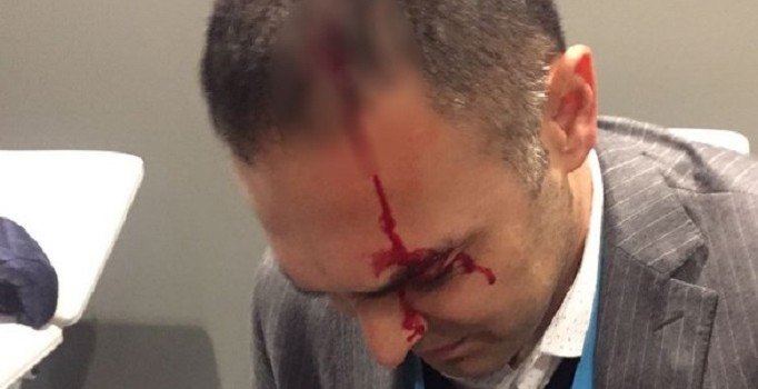 Olaylı derbi sonrası Fenerbahçe İdari Menajeri Çetinkaya'nın başı yarıldı