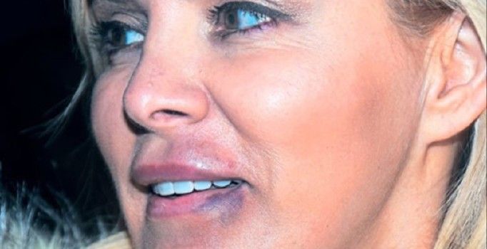 Ömür Gedik: Ferhat beni dövdü