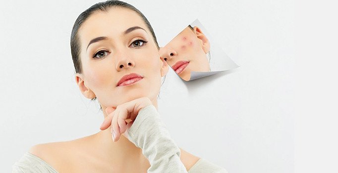 Sigaradan strese aknenin 9 nedeni