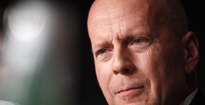 'Kel olmak iyidir dedirten 10 ünlünün saçlı hali