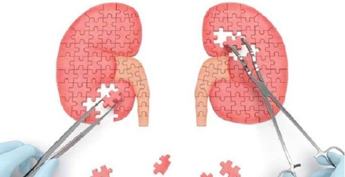 Böbrek sağlığı için 'şişmanlık' uyarısı
