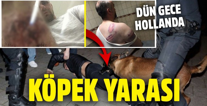 Hollanda polisinin köpekli müdahalesinde yararalananların görüntüleri çıktı