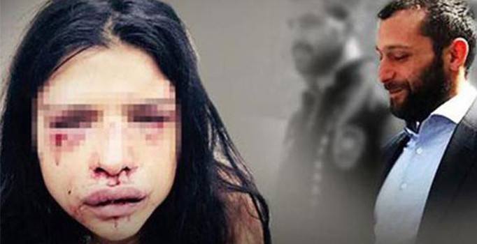 Bakanlık Onur Özbizerdik kararına itiraz etti: Üst sınırdan cezalandırılmalı