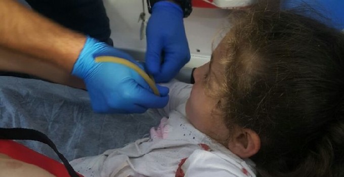 Koluna demir saplanan Suriyeli kızı itfaiye kurtardı | Mersin haberleri