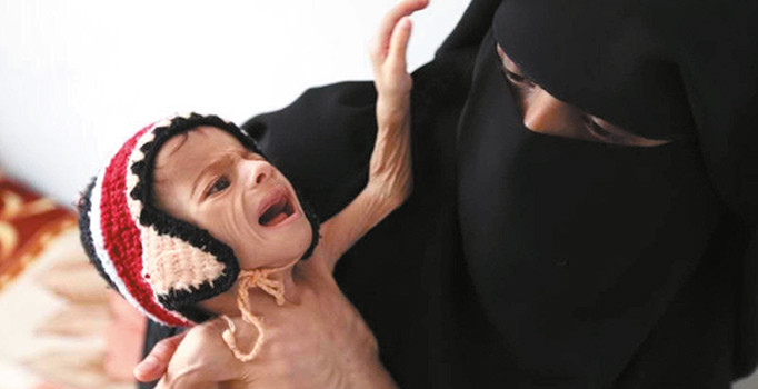 Yemen’de 17 milyon kişi yardıma muhtaç