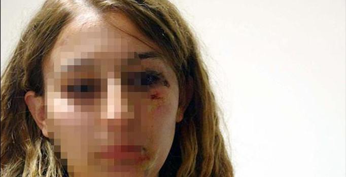 Kadın polise kuaförde dayak | Mardin haberleri