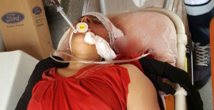 PKK/PYD sivilleri vurmaya devam ediyor