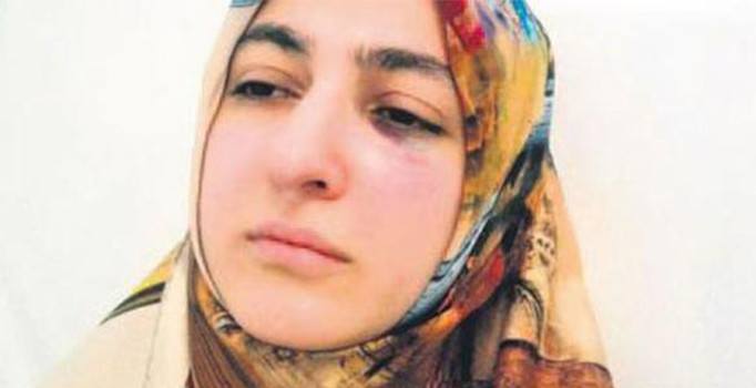 Kahramanmaraş'ta diş hekimine darp