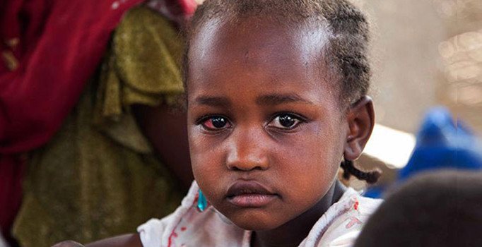 Trump'ın bütçe kesintisiyle 600 bin çocuk ölüm riski altında