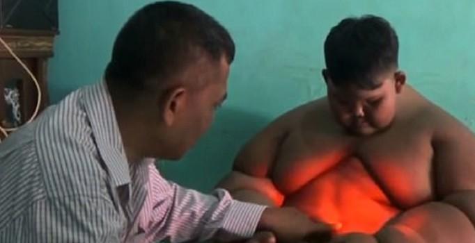 190 kilo olan 10 yaşındaki çocuk doktorlar sayesinde zayıflamaya çalışıyor