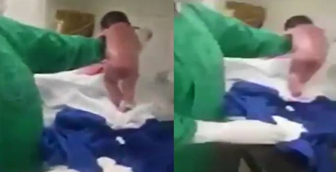 Doktorlar şoke oldu: Doğar doğmaz yürümeye çalıştı | Video izle