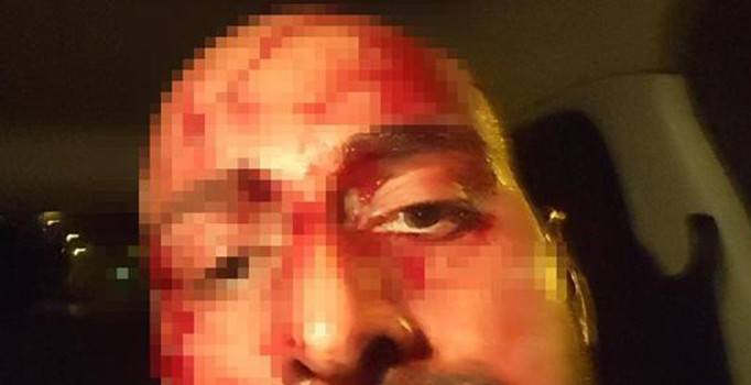 Belçika'da Türk dönerciye çirkin saldırı