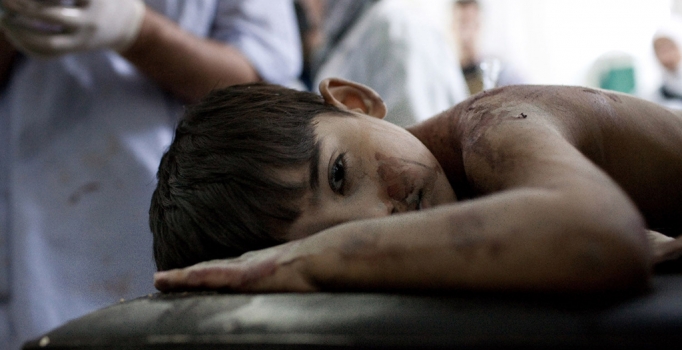 Suriye'de Rus uçaklarının yaraladığı çocuklar Türkiye'de tedavi ediliyor