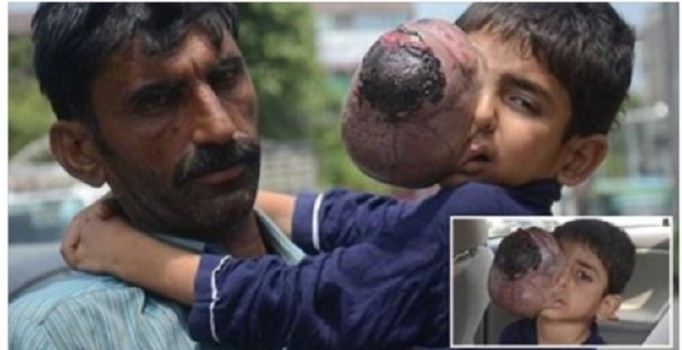 Boks şampiyonu Amir Khan, 7 yaşındaki kanser hastası çocuğa yardımcı oldu