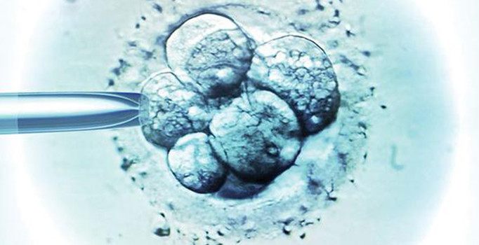 Hollanda şokta: 19 çocuğun babası tüp bebek doktoru çıktı