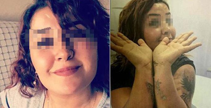 Dövmelerini sildirmek isteyen genç kız kabusu yaşadı