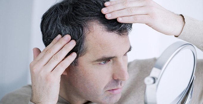 Saçı erken dökülen ve beyazlayanın kalbi tehlikede