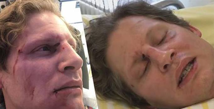 PKK yandaşları Türk dostu Alman gazeteciyi darp etti