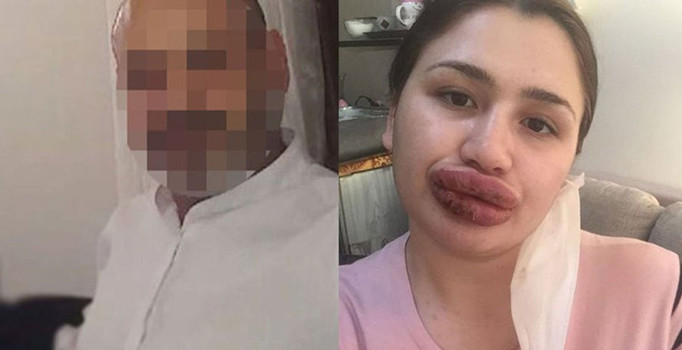 Adana'da 'sahte estetikçi' kuaföre 2 yeni dava