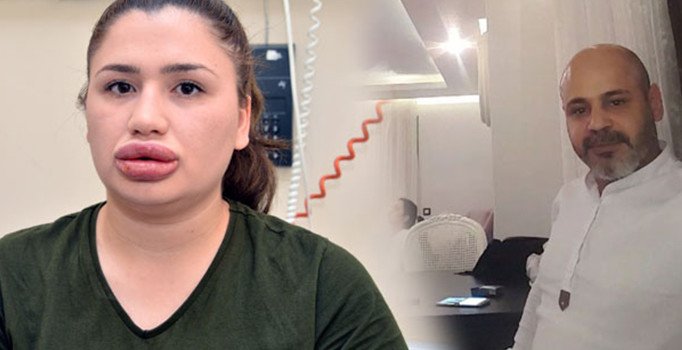 Sahte estetikçi Soner Gülnar'a tahliye