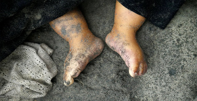 "Arakan'da cesetleri yakarak yok ediyorlar"