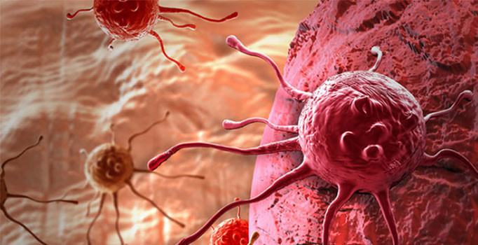 Kanseri 10 saniyede teşhis eden cihaz geliştirildi