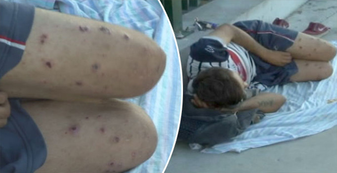 Sokak çocuğundan yürek yakan sözler: Çürümeye başladım