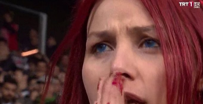 Kızıl saçlı taraftar maça damgasını vurdu