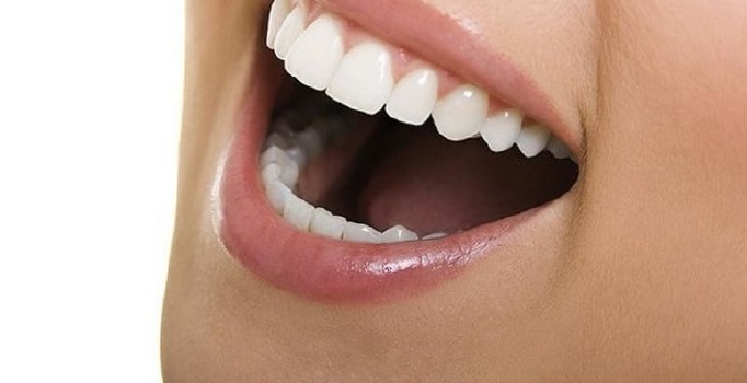 Çarpık dişlere görünmez çözüm
