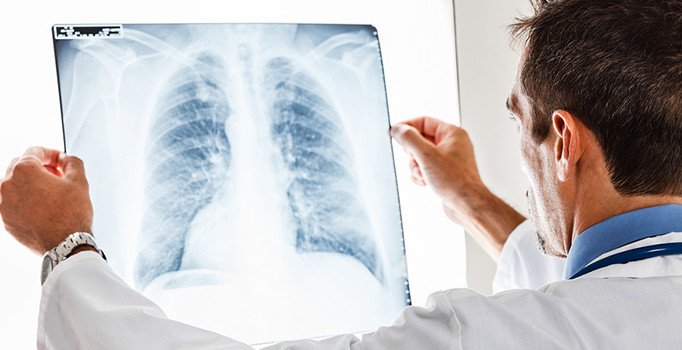 Sigara içen her 5 kişiden 1’i KOAH oluyor