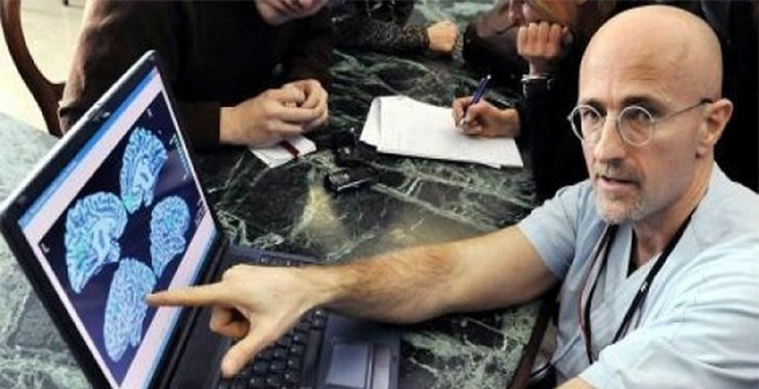 Dünyanın ilk kafa nakli gerçekleşti