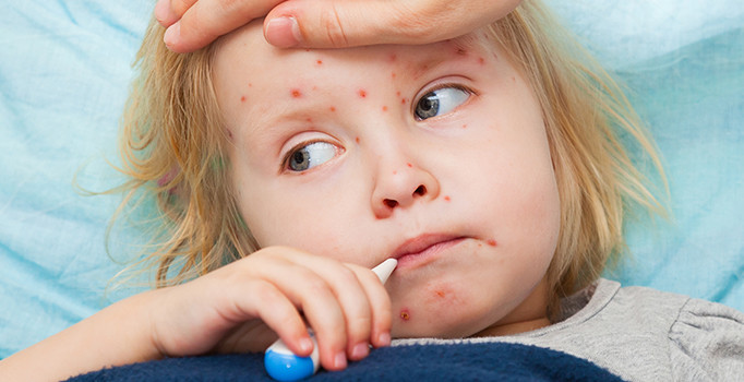 İngiltere: Leeds ve Liverpool'da kızamık salgını