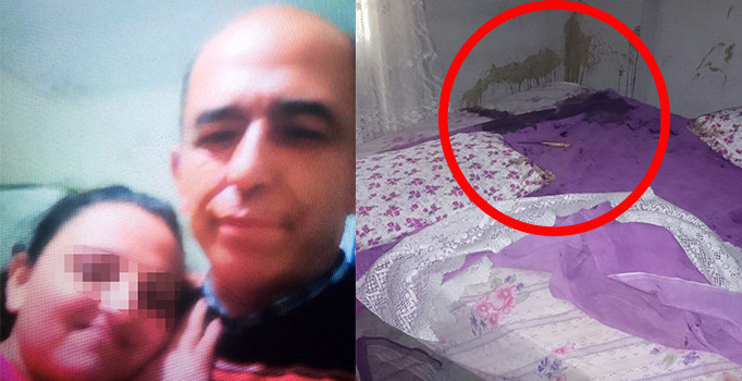 Kuma getirmek isteyen kocasını kızgın yağ ile yakmış