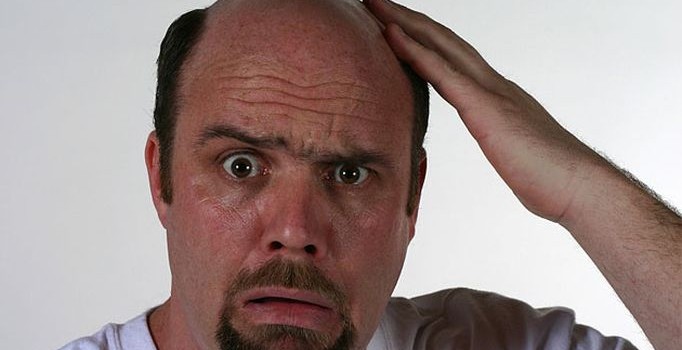 'Saç ekimi turizmi' Türkiye'ye yılda 1 milyar dolar kazandırıyor