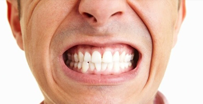 Diş etinde oluşan kanamalara dikkat