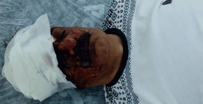 Kürt sanatçı Çiyager'in darp edilmesiyle ilgili 2 şüpheli gözaltına alındı