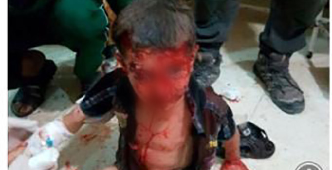 Sosyal medyada paylaşılan yaralı çocuk fotoğrafı 2016'da çekilmiş | Zeytin Dalı operasyonu